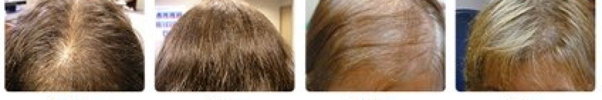 Antech Hair Clinic