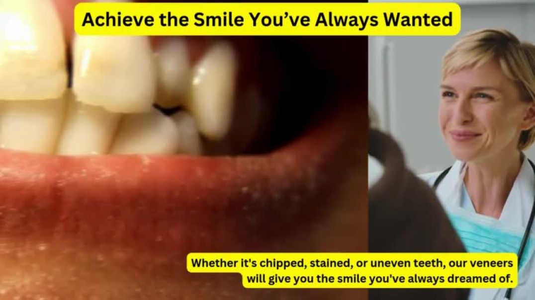 ⁣Professional Veneers Treatment in Parramatta  United Smiles Dental Experts