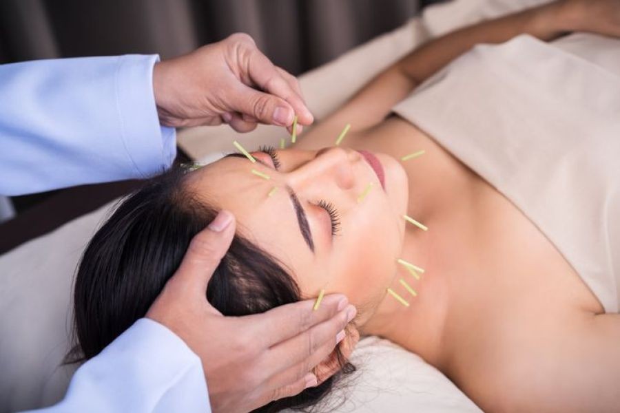 The Truth About Acupuncture: Does It Really Work? – What Smart Kiwis Are Doing Differently
