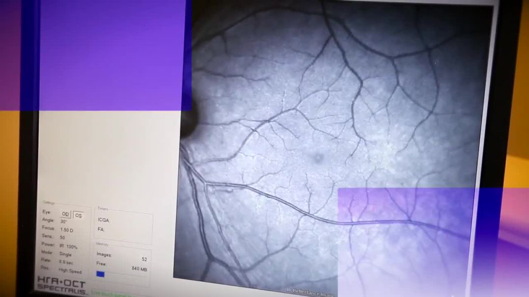 Vitreomacular Traction _ Macular Holes
