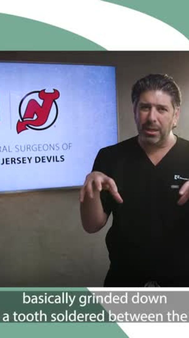 Why Are Implants Better Than 3-Unit Bridges_ With Dr. Jason M. Auerbach