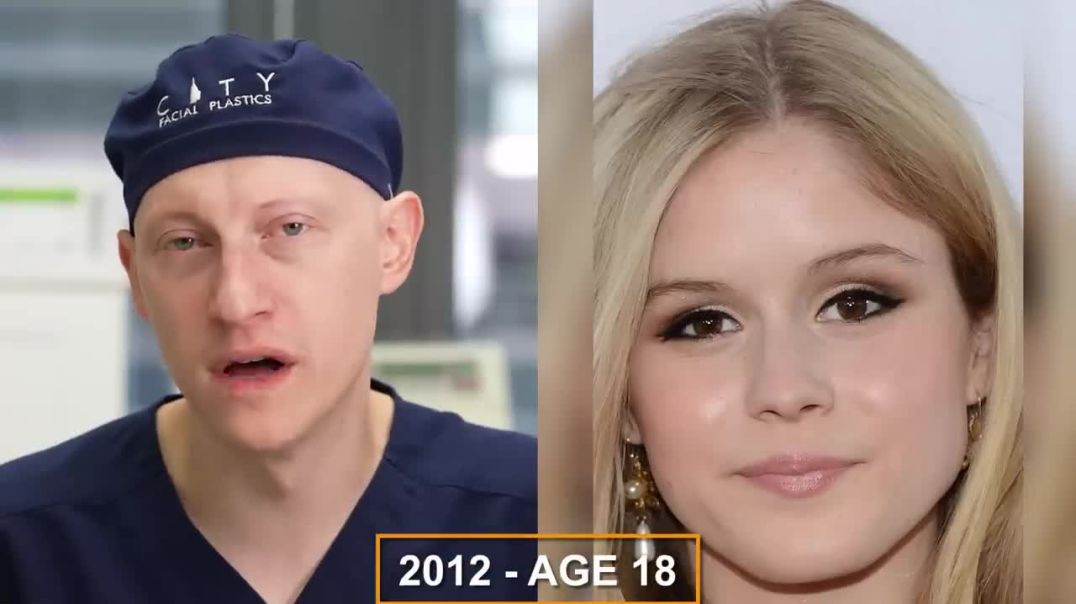 Erin Moriarty (The Boys) NEW FACE _ Plastic Surgery Analysis