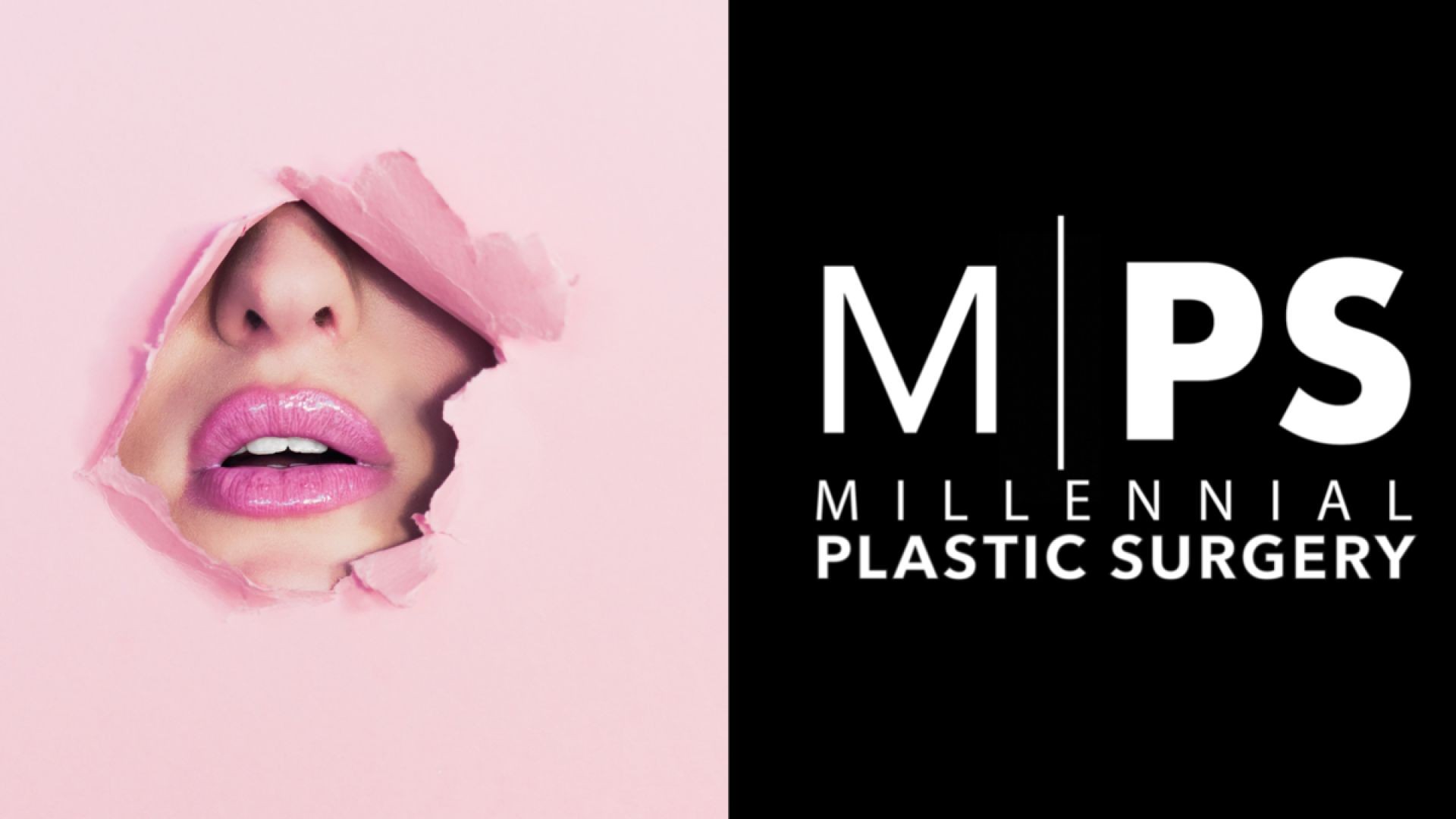 Millennial Plastic Surgery