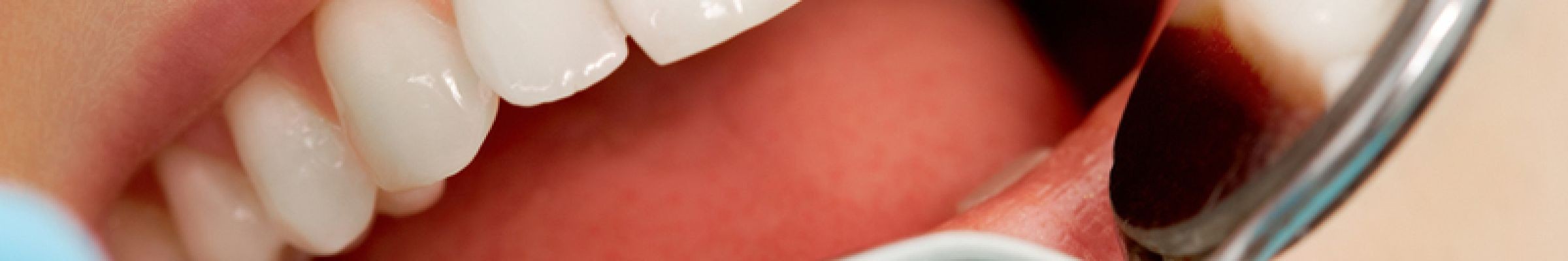 Beach Cities Dental Group