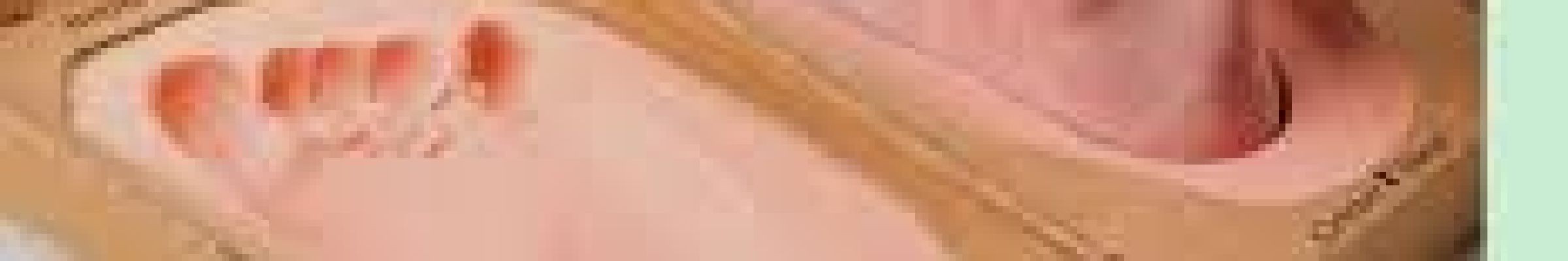 Flat Foot Therapy South Amboy