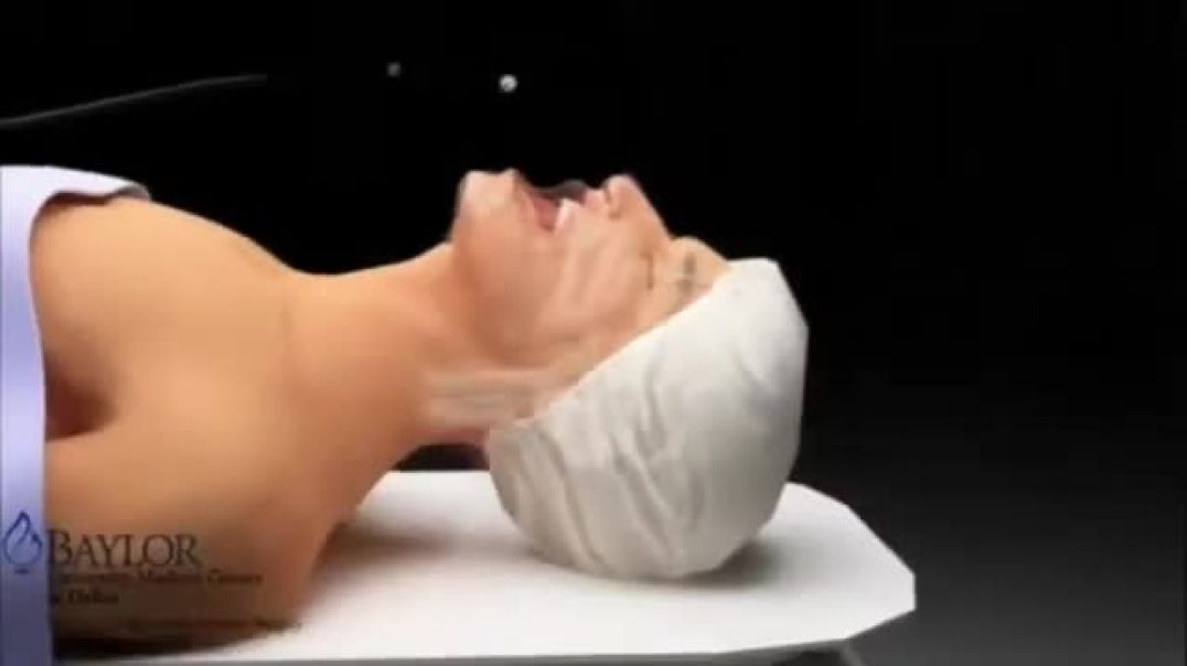 Endoluminal Vacuum Therapy (EVT/EVAC) Procedure | Step-by-Step Guide
