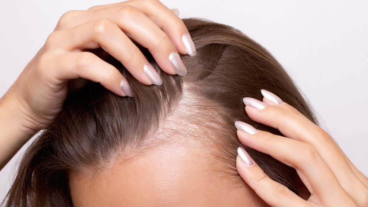 The Biggest Hair Loss Myths That Most Kiwis Believe (Debunked!) – What Industry Experts Are Saying